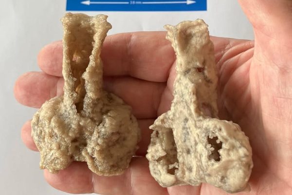 Why a 380-million-year-old fossil ‘fish’ from Scotland was discovered on the other side of the world